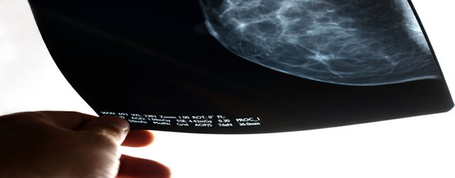 Mammography controversy