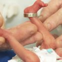 Babies born 23 weeks preterm: premature baby legs and adult hands