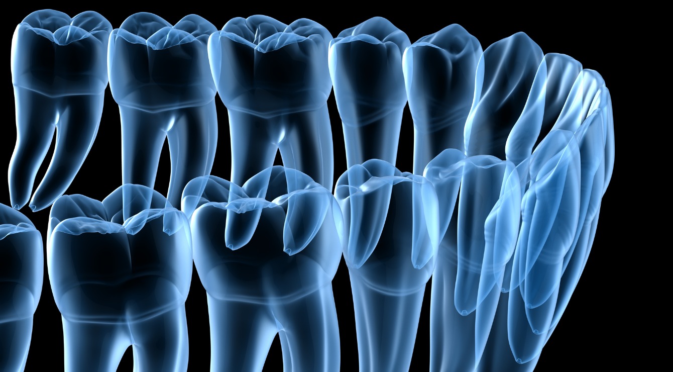 Your teeth can reveal how much radiation you’ve been exposed to